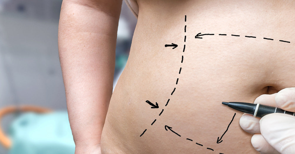 Understanding Visceral Fat and How to Effectively Monitor It for Better Health